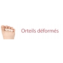 Orteils déformés